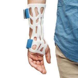 3D Printing Upper Limbs